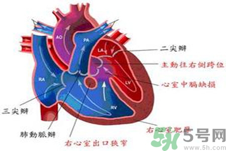 先天性心臟病需要注意什么？