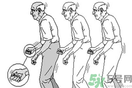 帕金森要注意哪些措施？帕金森的飲食需注意什么？