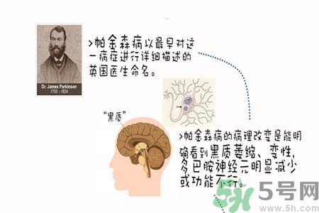 帕金森的治療方法有哪些？