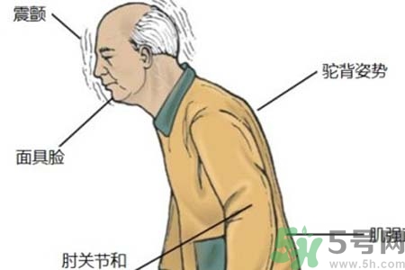 帕金森的易發(fā)人群有哪些？如何預(yù)防帕金森？