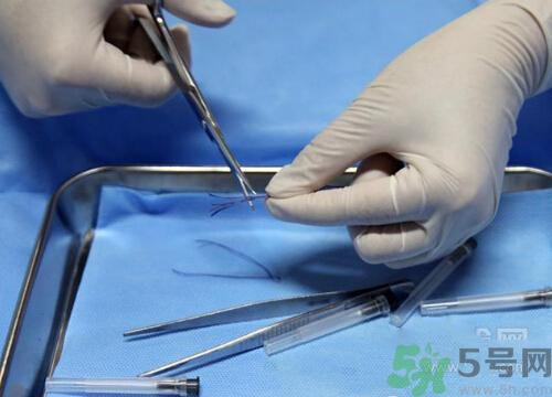 埋線減肥多少錢一次？埋線減肥的副作用