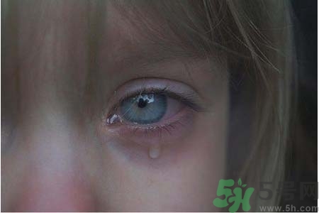 睡覺時(shí)流眼淚是怎么回事？如何保護(hù)眼睛？
