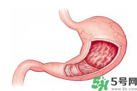 急性腸胃炎哪些食物不可以吃？急性腸胃炎不能吃的水果有？