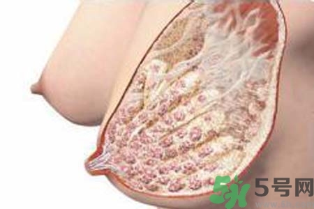乳腺增生治療方法是什么？乳腺增生的檢查方法有哪些？