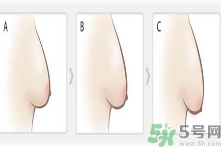 胸部松弛的原因是什么？胸部松弛該怎么辦？