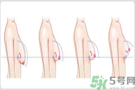 胸部松弛的原因是什么？胸部松弛該怎么辦？