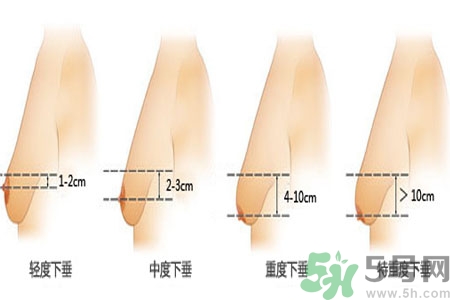 胸部松弛的原因是什么？胸部松弛該怎么辦？