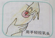 乳頭內(nèi)陷怎么回事？乳頭內(nèi)陷的原因是什么？