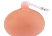 乳頭內(nèi)陷可以拔罐嗎？乳頭內(nèi)陷需要手術(shù)治療嗎？