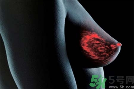 乳房上有硬塊怎么辦？乳房有硬塊的病因是什么？