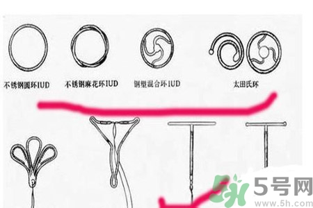 避孕的辦法有什么？避孕的方法有哪些？