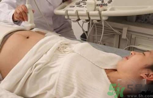 孕婦做b超要空腹嗎？孕婦做b超要不要空腹？