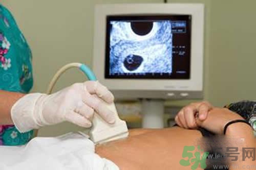 孕婦做b超要空腹嗎？孕婦做b超要不要空腹？