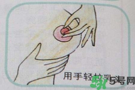 乳頭內(nèi)陷怎么矯正？乳頭內(nèi)陷矯正方法是什么？