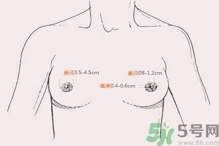 乳頭內(nèi)陷能不能喂奶？乳頭凹陷怎樣哺乳？
