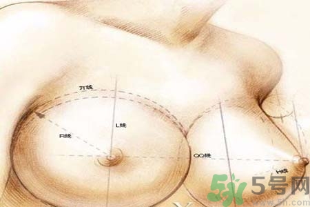 乳頭內(nèi)陷可以用吸奶器嗎？乳頭內(nèi)陷能不能用吸奶器？