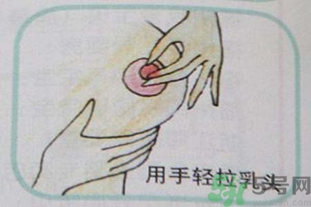 乳頭內(nèi)陷可以拔罐嗎？乳頭內(nèi)陷需要手術治療嗎？