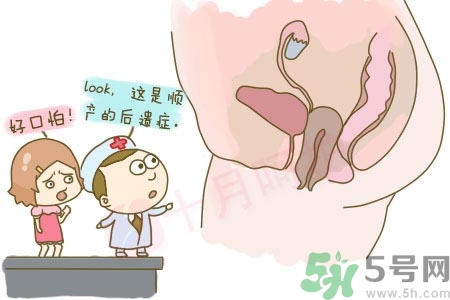 陰道松弛是什么？陰道松弛的癥狀有哪些？