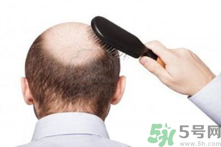 產生中年危機的原因是什么？男性中年危機的好發(fā)年齡？