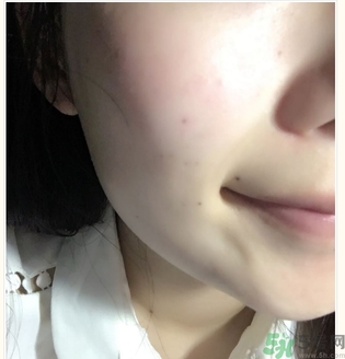 麗得姿面膜適合孕婦可以用嗎？麗得姿面膜哪些孕婦可以用？