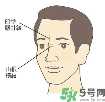 耳垂上有豎紋是怎么回事？山根有橫紋是什么?。?></p><h3>山根</h3><p>鼻尖是臉部最高的部位，就像山峰一樣，而位於兩眼內(nèi)側(cè)眼頭之間的鼻梁低處，是鼻子開始要隆起的地方，相對於鼻子高度最低，所以稱為「山根」，它與心臟關(guān)系最密切。正常的山根，高度應(yīng)該與鼻子和面部的比例相合，而且要有隆起的樣子，光滑無橫紋，沒有青筋。</p><p>許多壯年猝死的人，如人稱科技游俠的溫世仁先生（腦干出血），藝人戎祥、馬兆駿（心肌梗塞）等，他們的山根都比較低陷，幾乎與兩側(cè)的眼頭一樣高。</p><p>●山根低陷或出現(xiàn)橫向細紋：山根低陷除非是外傷，否則通常是先天的結(jié)構(gòu)；山根橫紋則常在身體使用多年、身心壓力大的中年以後出現(xiàn)，而且多兼有皺眉的習(xí)慣。</p><p>●山根青筋：較常出現(xiàn)在小孩子身上，表示曾受驚嚇，心神不安，睡覺時多會翻覆，情緒比較不太穩(wěn)定。</p><p style=