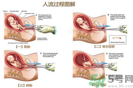 人流后怎么調(diào)養(yǎng)身體？人流后飲食需注意什么？