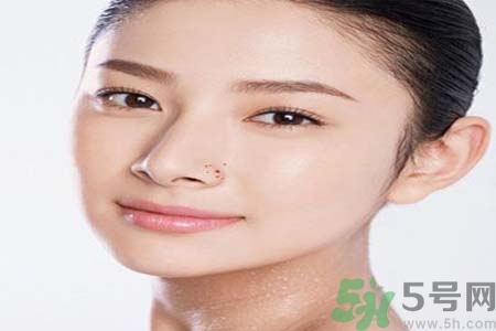 太陽(yáng)穴長(zhǎng)痘怎么辦？如何祛除太陽(yáng)穴上的痘痘？