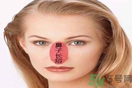 鼻子兩側(cè)長(zhǎng)痘怎么辦？鼻子兩側(cè)長(zhǎng)痘怎么回事？
