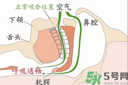 鼻子紅是什么原因？鼻子紅怎么辦？