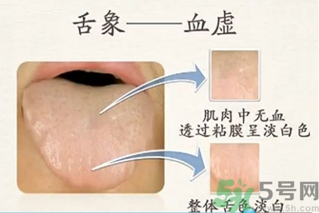 血虛的癥狀是什么？血虛的表現(xiàn)有哪些？
