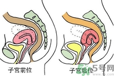 ?子宮移位怎么治療？子宮移位能懷孕嗎？