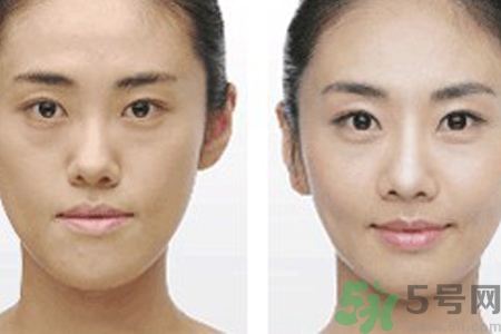 激光縮毛孔多少錢(qián)一次？激光縮毛孔一個(gè)療程多少錢(qián)？