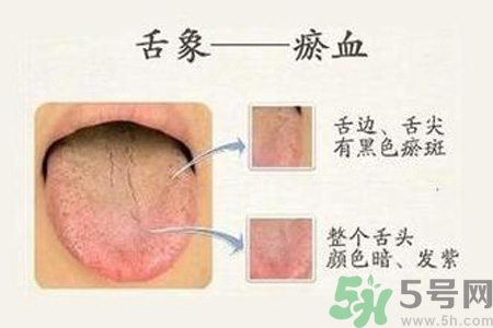 血瘀體質(zhì)吃什么？血瘀體質(zhì)怎么調(diào)理？