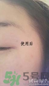 dr.jart適合什么年齡層？蒂佳婷適合年齡