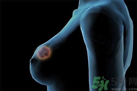 什么是乳溝？乳溝的類型有哪些？?
