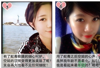 蛇毒眼膜孕婦可以用嗎？ 日本spa蛇毒眼膜孕婦能用嗎？