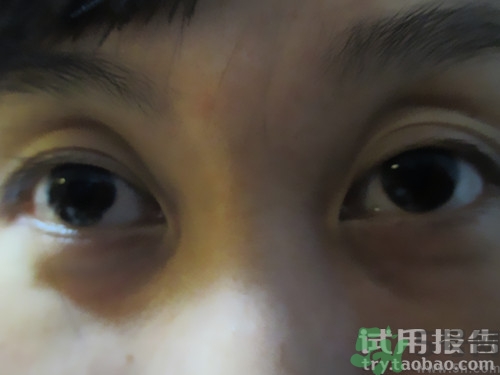 蛇毒眼膜效果怎么樣？spa蛇毒眼膜紅色好用嗎？
