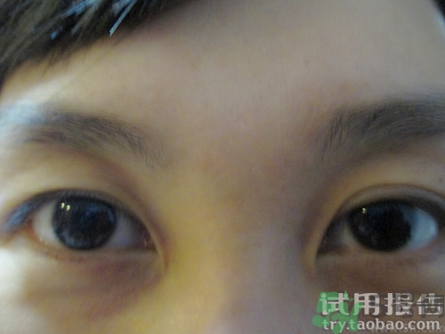 蛇毒眼膜效果怎么樣？spa蛇毒眼膜紅色好用嗎？