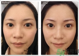 眉毛怎么整形好看？眉毛怎么整自然？
