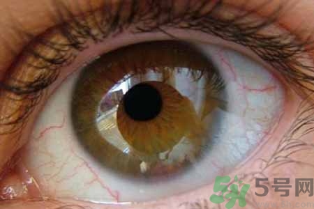 ?干眼癥的治療方法是什么？如何預(yù)防干眼癥？