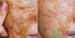 思親膚在韓國(guó)什么檔次？skin food在韓國(guó)怎么樣？