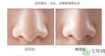 yu.r巧克力棒鼻貼怎么樣？yu.r巧克力鼻貼好用嗎？