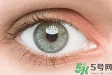 黑眼圈是怎么形成的？黑眼圈是什么原因引起的？