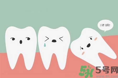 智齒橫著長(zhǎng)怎么辦？智齒橫著長(zhǎng)一定要拔了嗎？