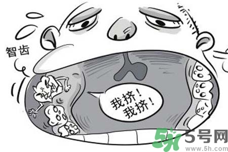 智齒橫著長(zhǎng)怎么辦？智齒橫著長(zhǎng)一定要拔了嗎？