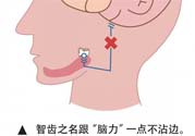 長(zhǎng)智齒疼痛怎么辦？長(zhǎng)智齒牙齦腫了怎么辦？