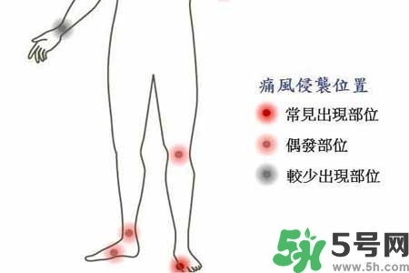 引發(fā)痛風(fēng)的原因是什么？痛風(fēng)病人飲食需注意什么好？