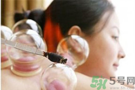 月經(jīng)可以拔火罐嗎？經(jīng)期可以拔火罐嗎？
