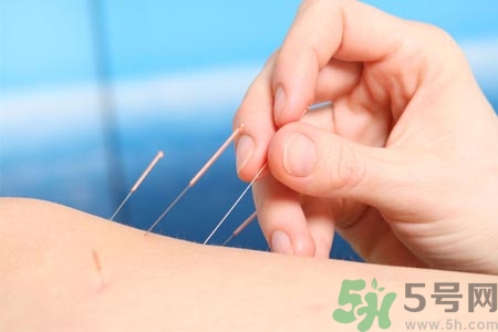 針灸一次要扎多長(zhǎng)時(shí)間？針灸可以幾天做一次？