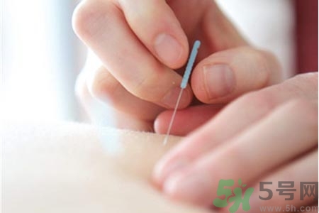 針灸一次要扎多長(zhǎng)時(shí)間？針灸可以幾天做一次？